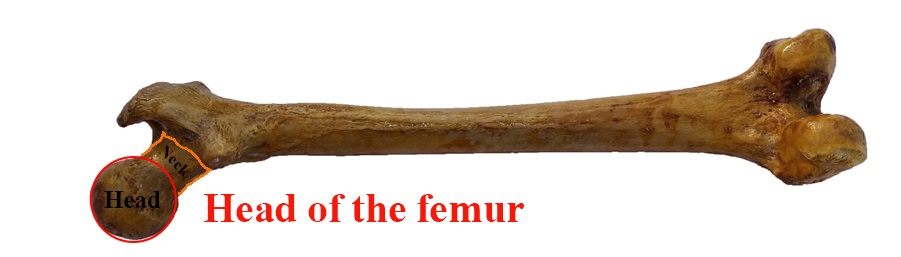 Head of the femur